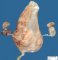 Prune belly sequence by urethral obstruction sequence with megacystis (Case (...)
