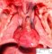 Left ventricle hypoplasia with aortic arch hypoplasia (Fetus)