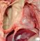 Pleural empyema
