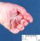 Transverse palmar crease