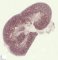 EMA immunolabelling in renal tubular dysgenesis