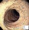 Intestinal mucosa in Anderson disease