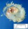 Embryo 17 mm (7 weeks)