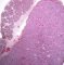Fetal testis (22 weeks)
