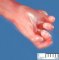 Post-axial polydactyly in Meckel syndrome
