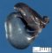 Testicular hemorrhagic necrosis by spermatic pedicule torsion