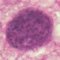 Toxoplasma gondii cyst in brain tissue stained with hematoxylin and eosin (...)