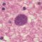 Toxoplasma gondii cyst in brain tissue stained with hematoxylin and eosin (...)