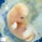 Embryo 17 mm (7 weeks)