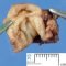Ileocaecal atresia