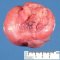 Primitive myxoid mesenchymal tumor of infancy (PMMTI)