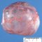 Pre-pancreatic mucinous cystadenoma