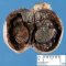 Hemorragic and ischemic necrosis of the testis in spermatic cord (...)