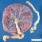 Nornal (central) insertion of umbilical cord