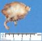 Chronic interstitial nephritis