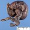 intestinal intussuspection on Meckel diverticula