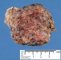 Retropancreatic cystic lymphangioma
