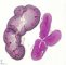 Fetal kidney 20 weeks