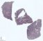 Fetal lung 22 weeks