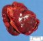 Polysplenia in malformative association
