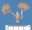 Fetal oligocystic kidneys of unknow cause (case 11389)