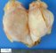 Parosteal desmoid fibromatosis in fibular pachydysostosis