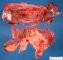 Splenic mesothelial cyst (open)