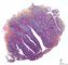Tonsil