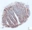 Tonsil - BCL2 immunostaining
