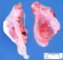 Ovotestis (Left) and testis (Right)