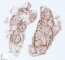 Lobular capillary hemangioma