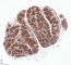 Tonsil - CD20 immunostaining