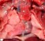 Visceral isomerism in Ivemark syndrome: dextrocardia and bilateral trilobal (...)