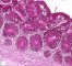 Fetal colon 24 weeks