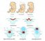 Neural tube defects