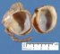 Colonic duplication (ileocecal junction)
