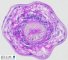 hydatid cyst : protoscolex with refractile hooklets