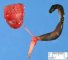 Unilateral renal agenesis in caudal regression syndrome with lombosacral (...)