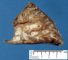 Bronchiectasis and BALT hyperplasia (Case 11750)