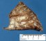 Bronchiectasis and BALT hyperplasia (Case 11750)