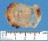 Human embryo 12mm