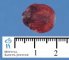Intestinal myoepithelial hamartoma