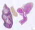 Fetal adrenal 20 weeks