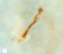 GD4: Stunted embryo