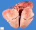 Dextrocardia in situs inversus (24 weeks)