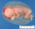 Fetus in amniotic sac - 14 weeks