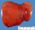 Hepatic ischemia in a systemic sepsis