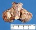Brainstem and cerebellum (1 month)
