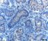 Germ cell proliferation in cryptorchidism (CD117)