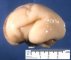 Fetal brain 22 weeks